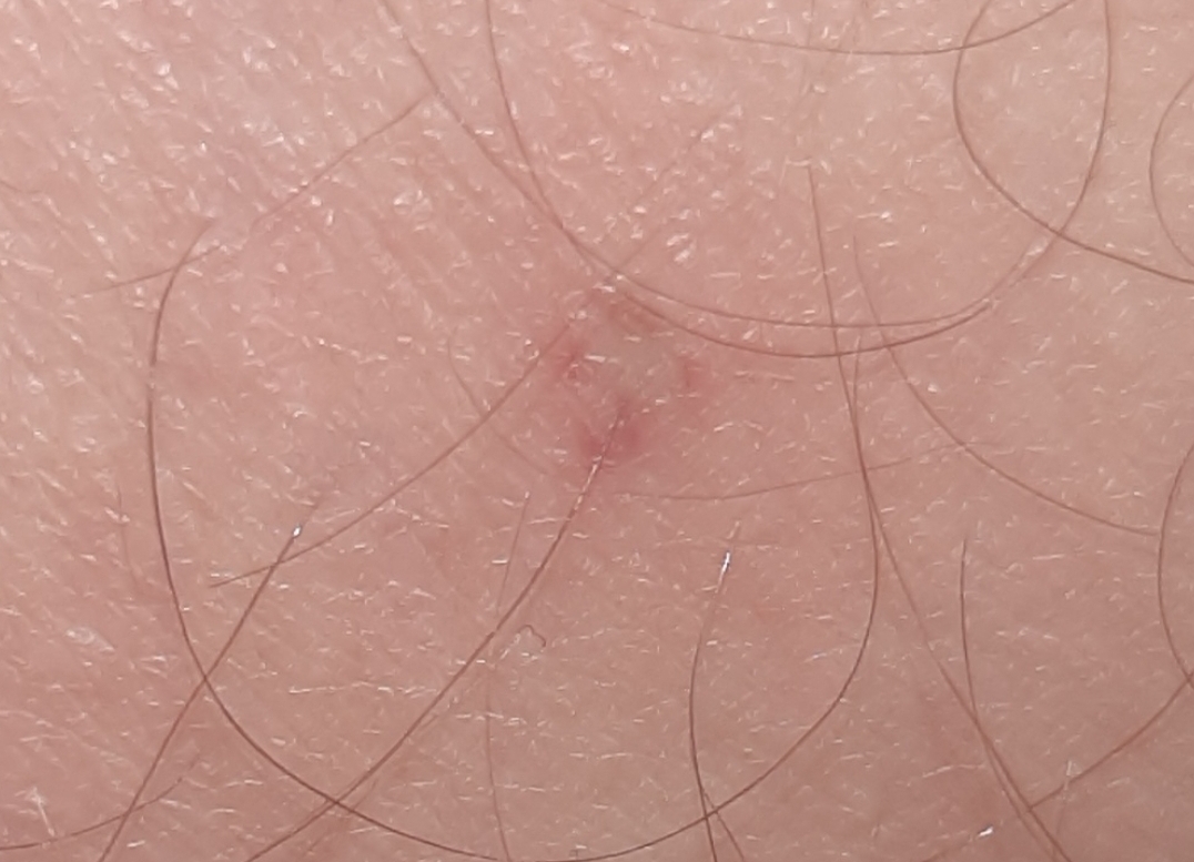 https://rehost.diberie.com/Picture/Get/f/536382